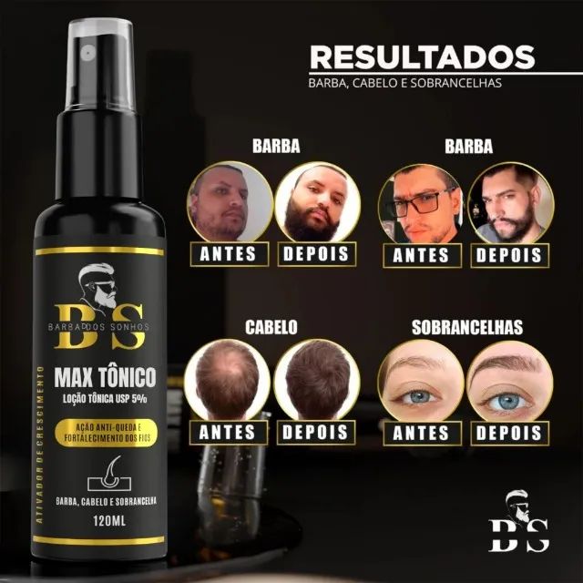 Promoção Shopee! Tônico Capilar Max - Ideal para Cabelo, Barba e Sobrancelhas - Foto 4