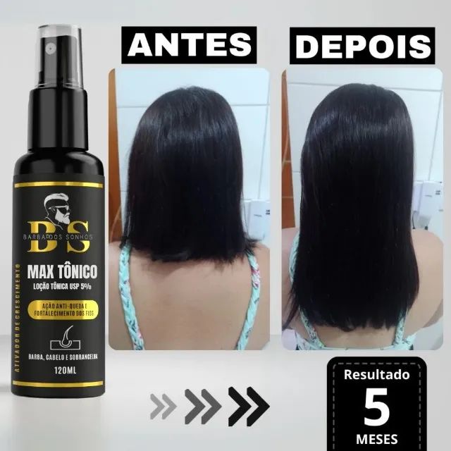Promoção Shopee! Tônico Capilar Max - Ideal para Cabelo, Barba e Sobrancelhas - Foto 2