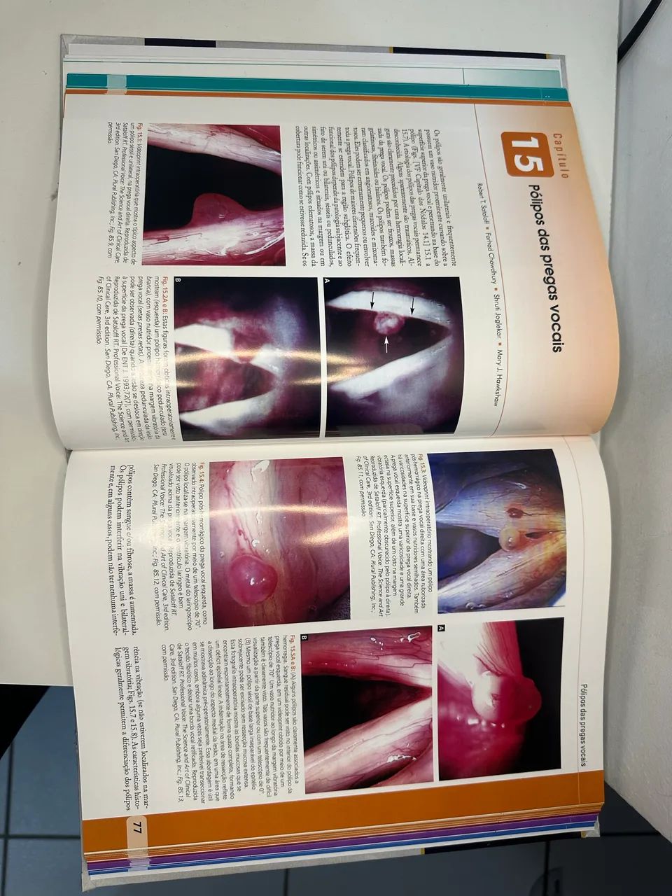 Endoscopia de Laringe? Atlas - Foto 5