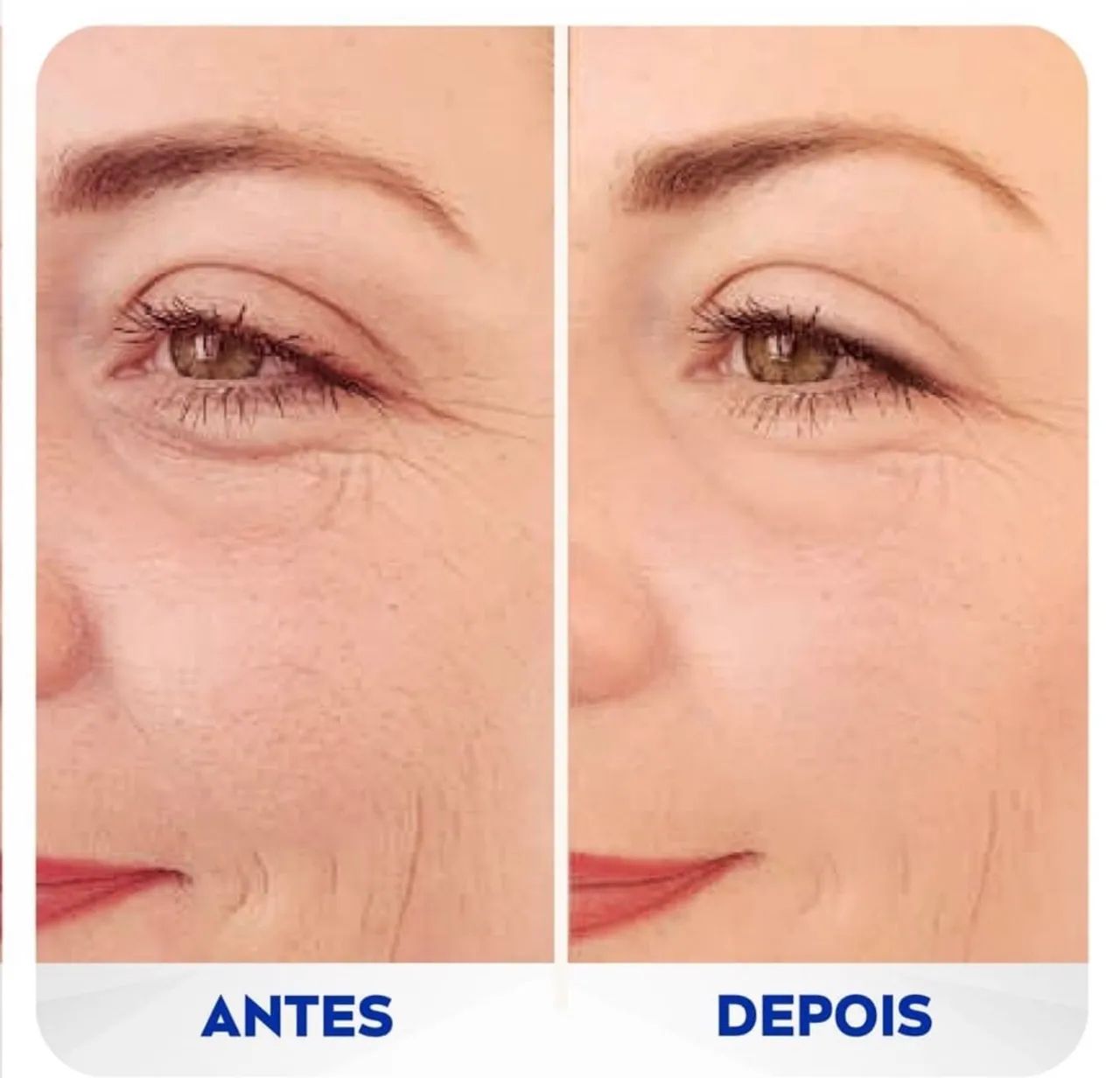 Creme Antissinais Nivea  - Foto 4