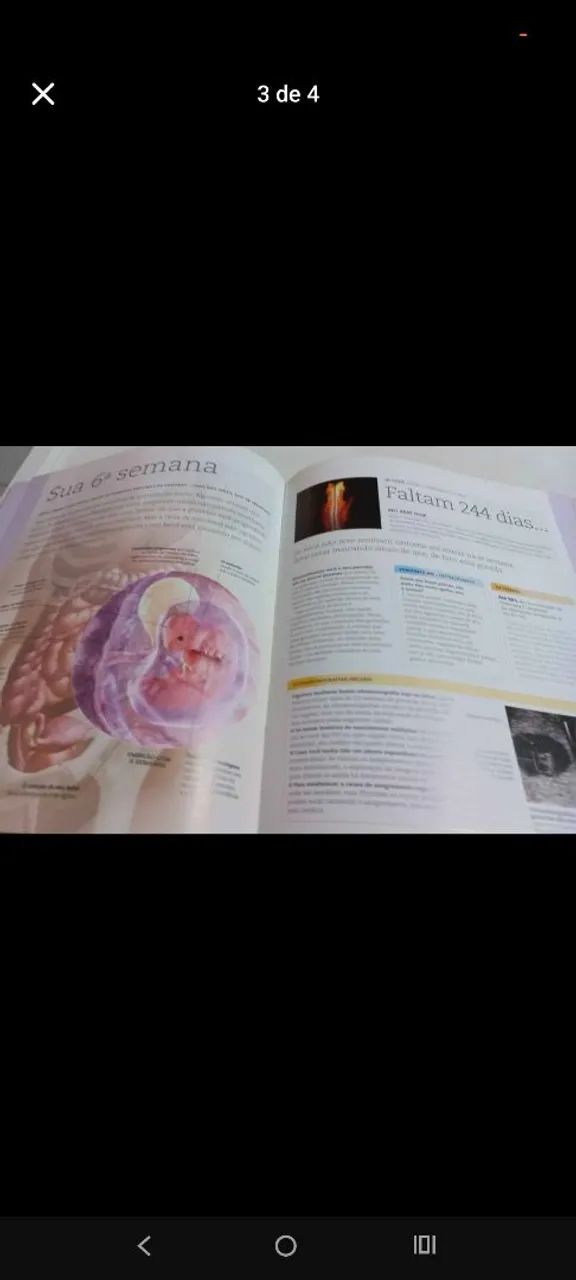 Livro A Gravidez Dia a Dia - Foto 4