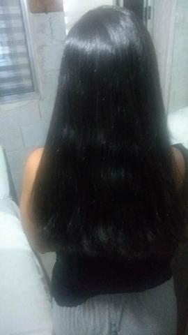 Progressiva e botox