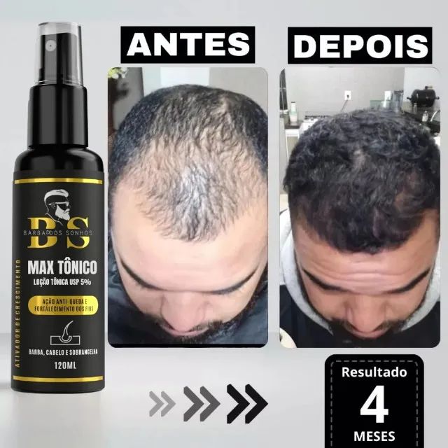Promoção Shopee! Tônico Capilar Max - Ideal para Cabelo, Barba e Sobrancelhas - Foto 5
