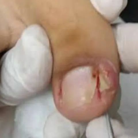 Podologia  - Foto 3