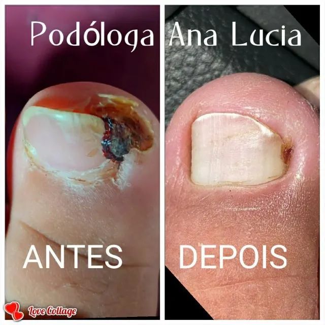 Podologia  - Foto 2
