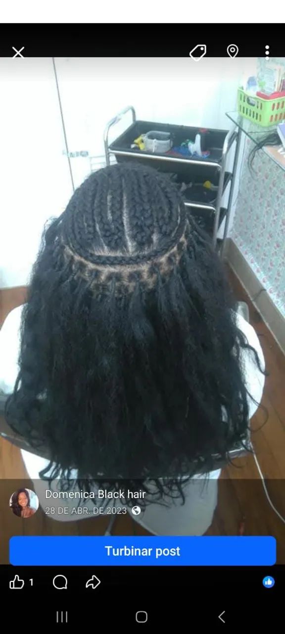 Colocação de cabelo - Foto 2