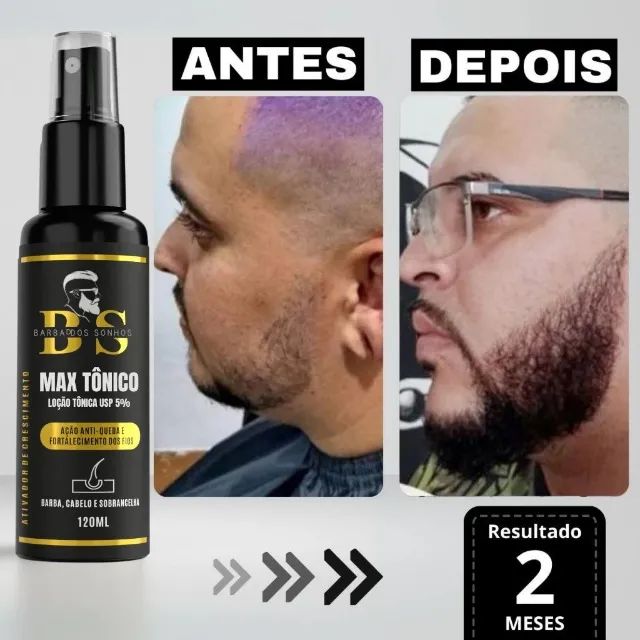 Promoção Shopee! Tônico Capilar Max - Ideal para Cabelo, Barba e Sobrancelhas