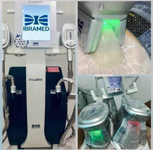 Equipamento criolipólise polarys ibramed
