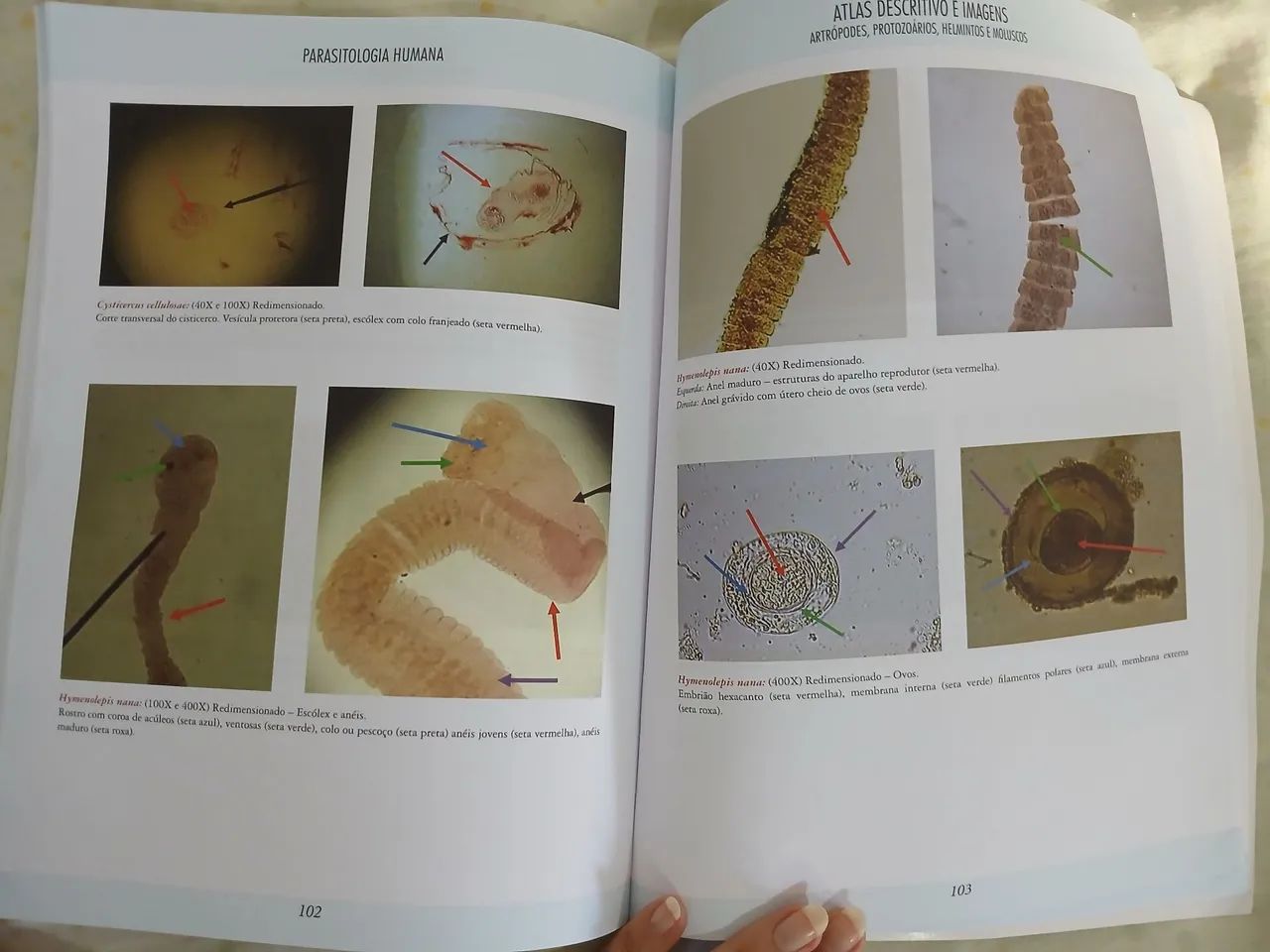 Atlas de Parasitologia Humana - 2ª edição - Foto 3