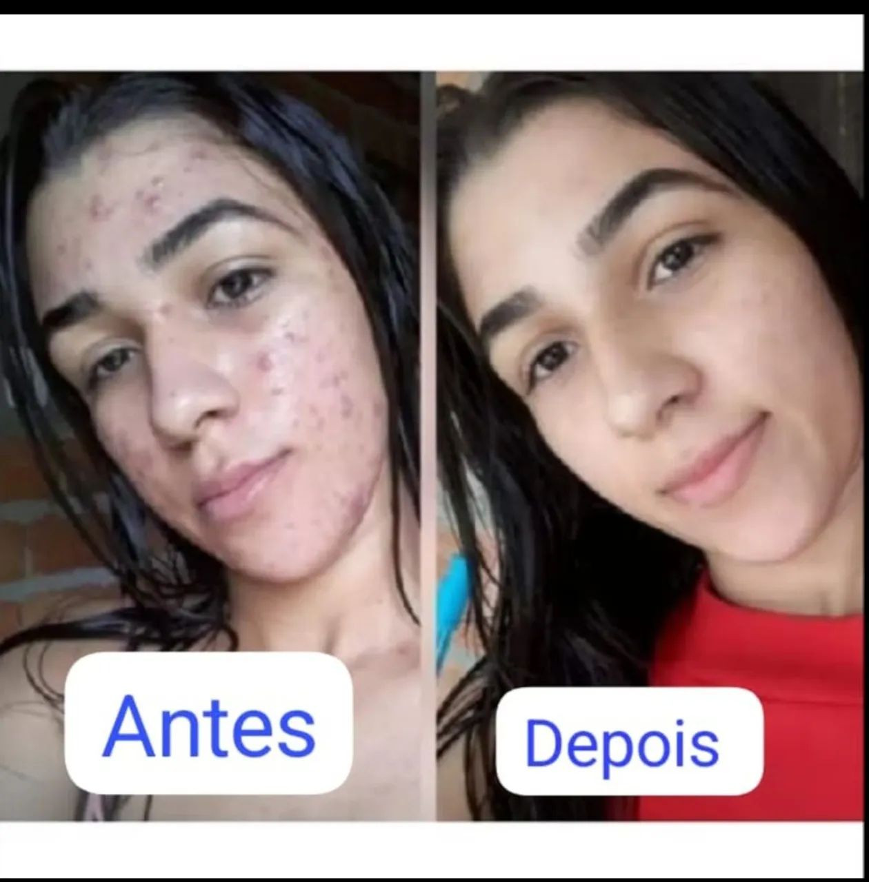 Creme de Tratamento Facial  - Foto 3