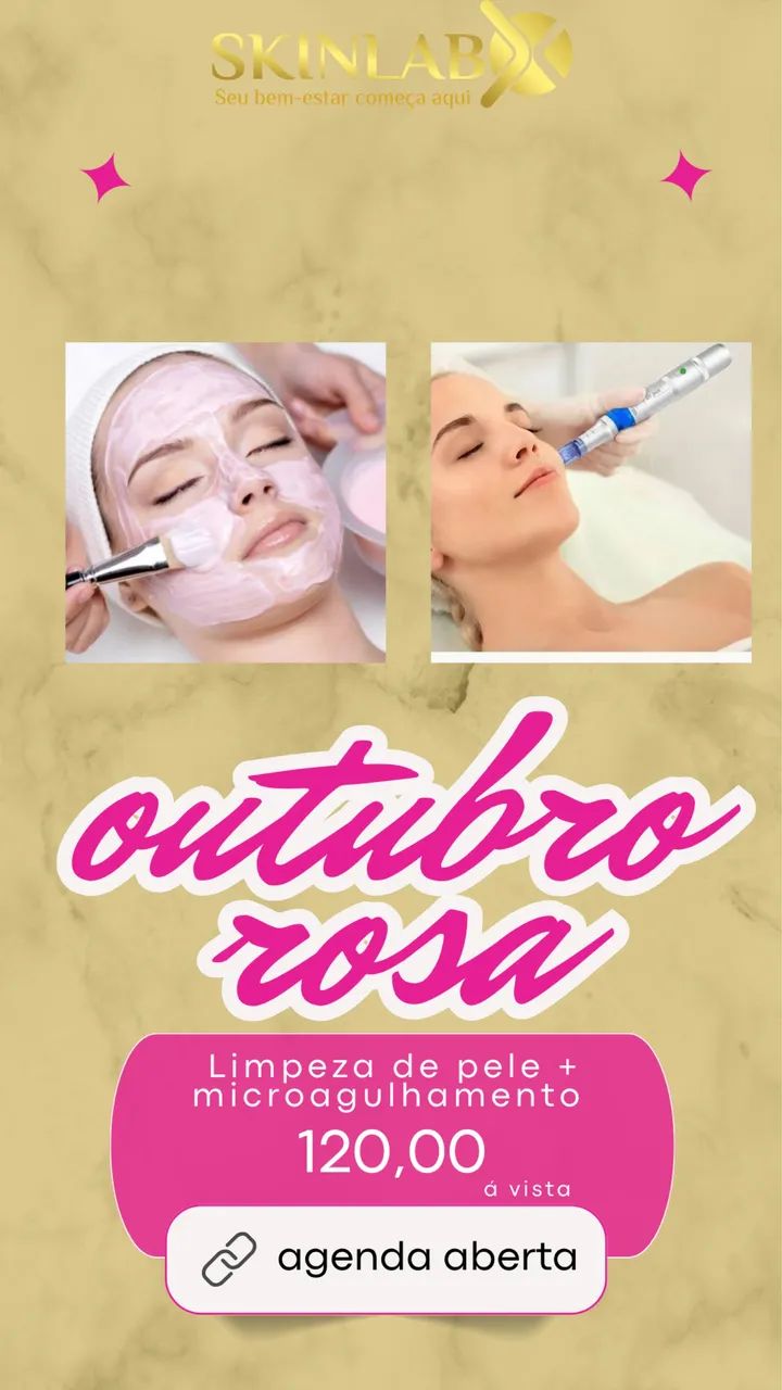 Remoção de tatuagem  - Foto 5