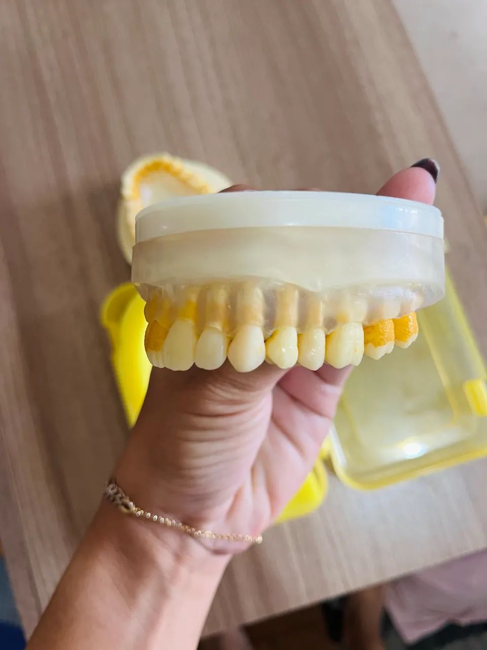 Refil de Periodontia Pronew - Foto 3