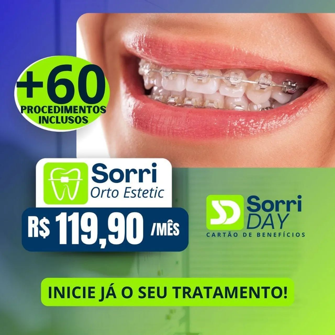 Aparelho Ortodôntico - SorriDay - Foto 4