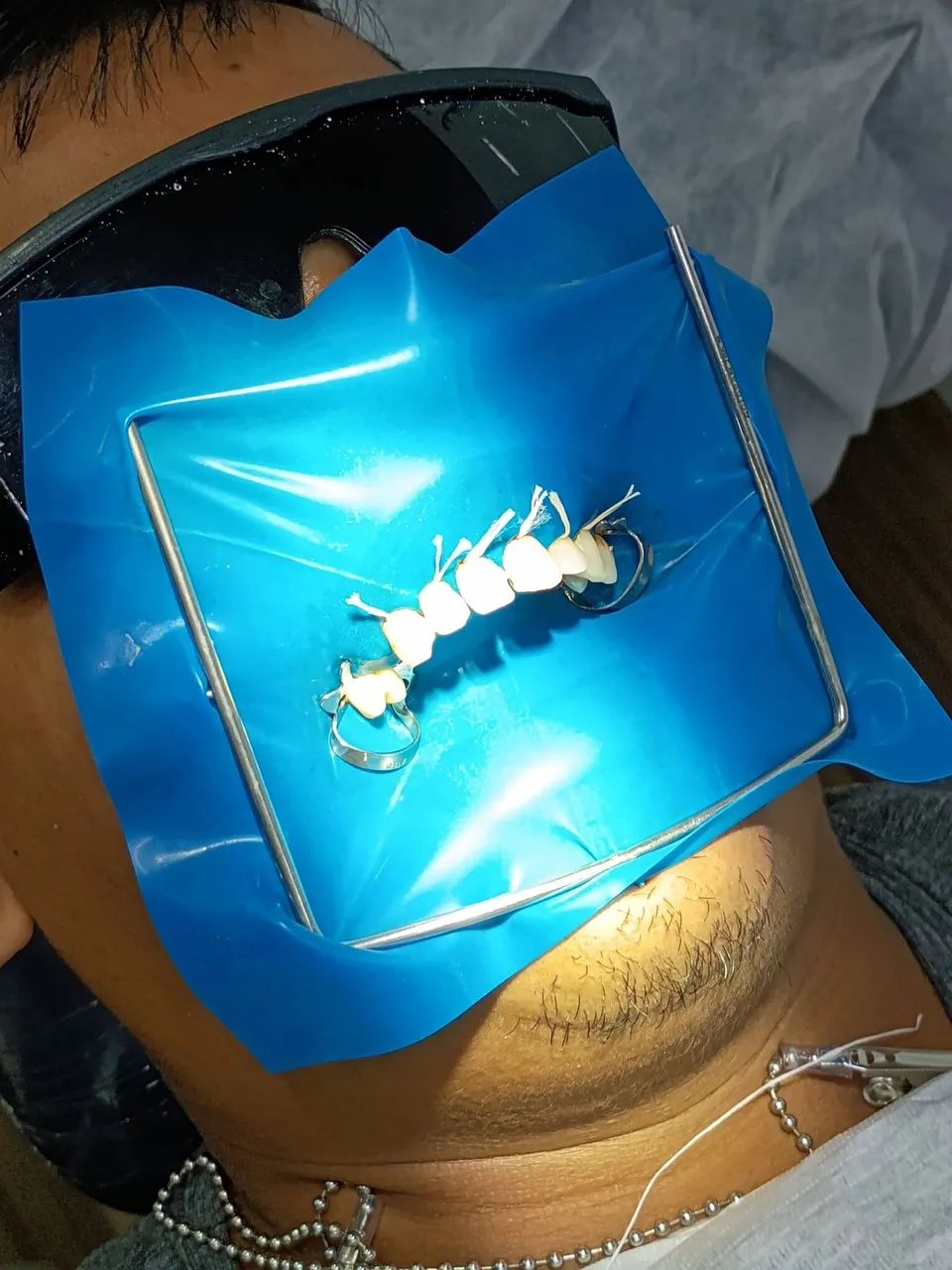 Paciente para odontologia  - Foto 3