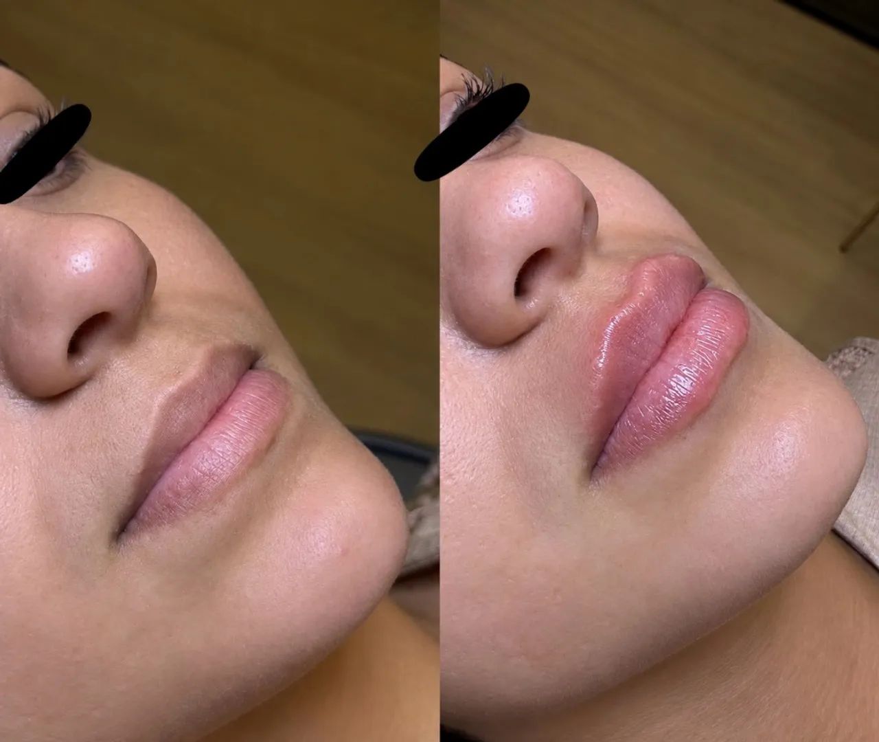 Preenchimento Labial R$450