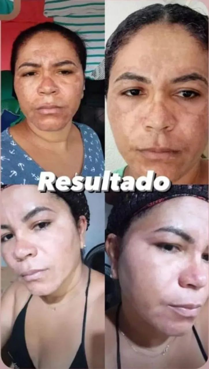 Creme de Tratamento Facial  - Foto 4