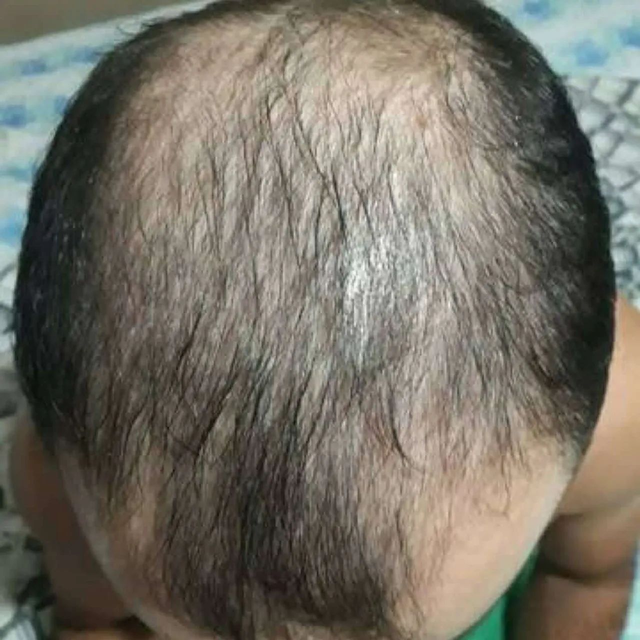 LOÇÃO FORTALECIMENTO E CRESCIMENTO CAPILAR 15% 120 ML - Foto 2