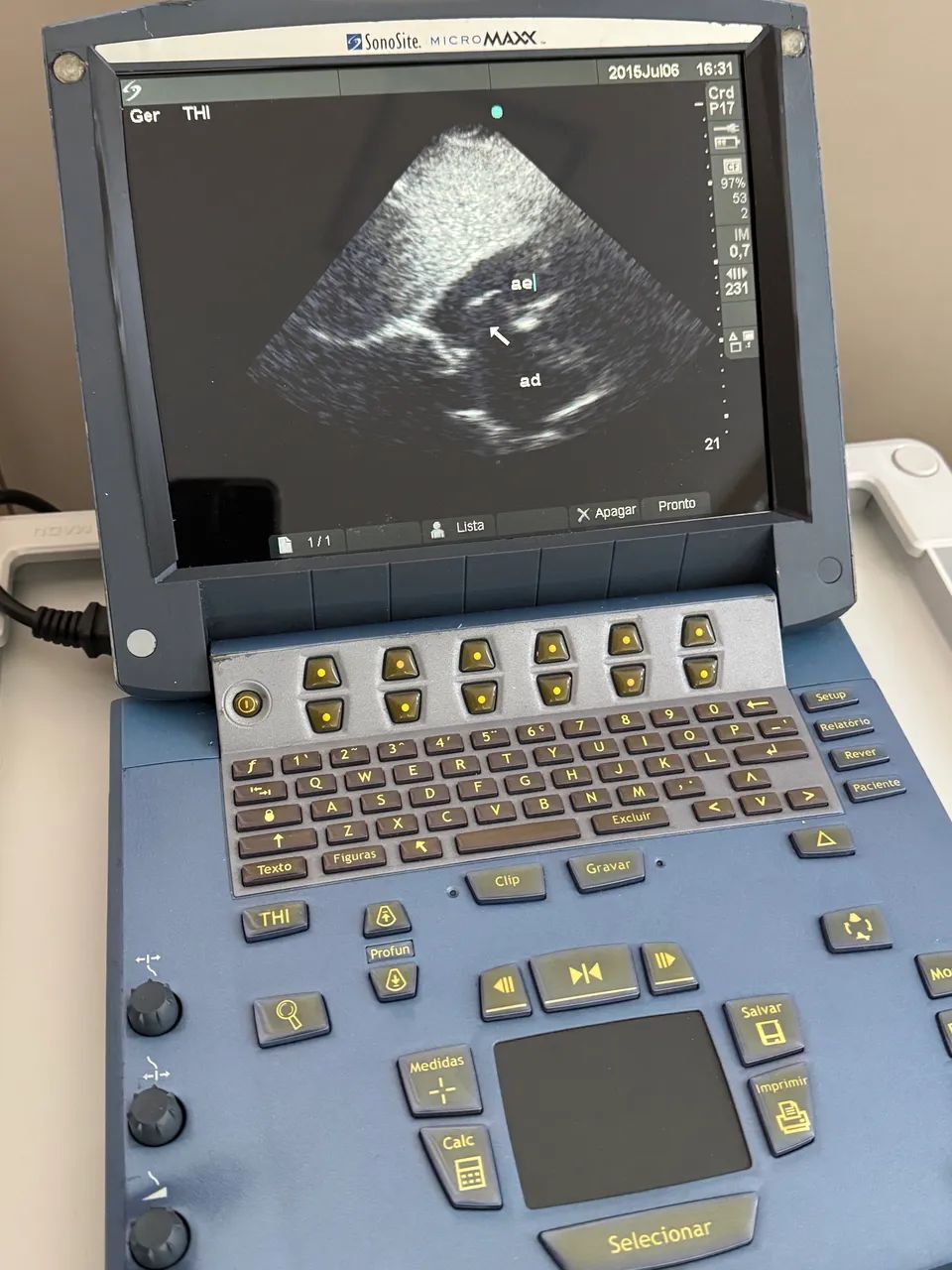 Ecocardiograma transtoracico Sonosite com sonda setorial - Foto 2