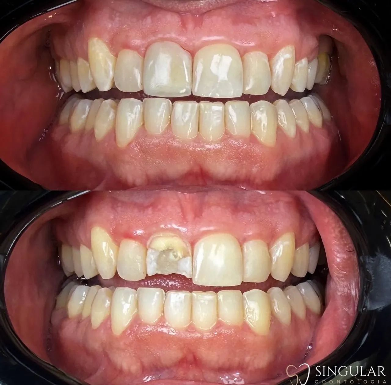 UM SORRISO SAUDÁVEL, BONITO E CUIDADO EM CADA DETALHE. - Foto 3