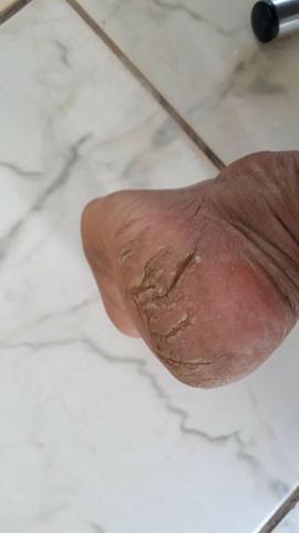 Podologia - Foto 4