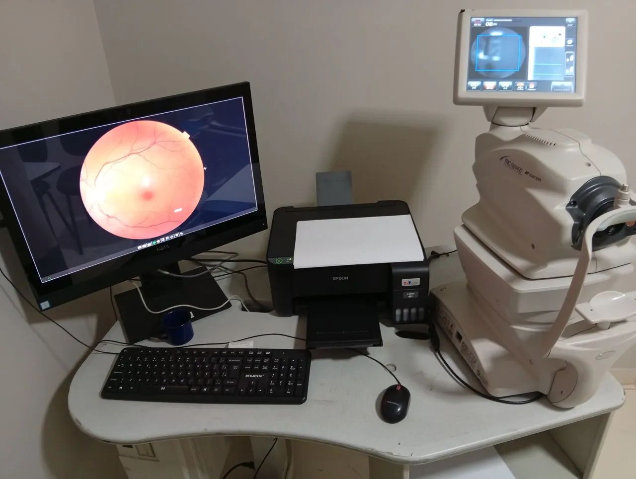 Retinógrafo Topcon TRC-NW 400