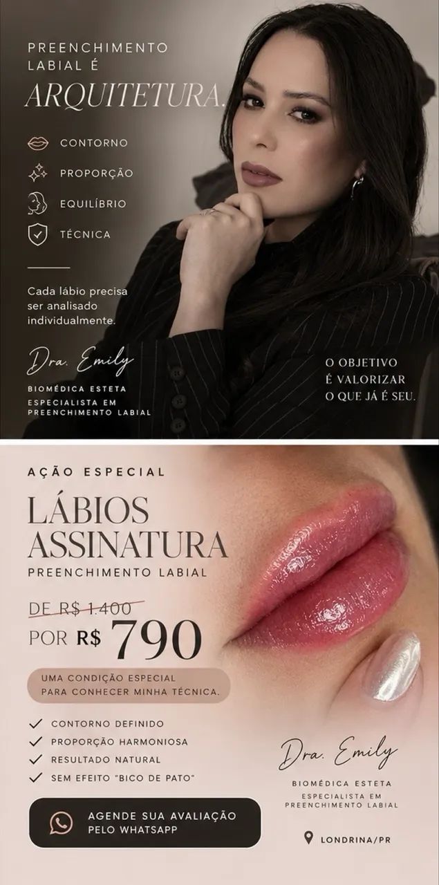 Preenchimento labial  - Foto 2