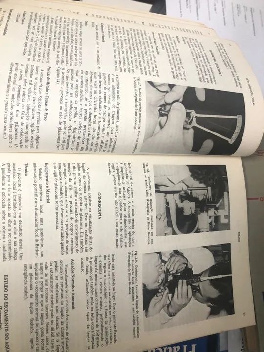 LIVRO - Oftalmologia Geral 2a edição - Daniel Vaughan e Taylor Asbury - 1983 - Foto 2