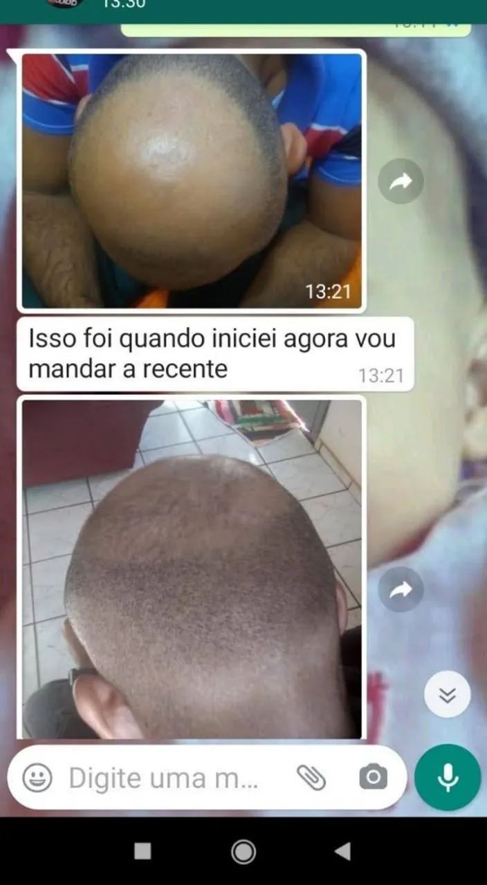 LOÇÃO FORTALECIMENTO E CRESCIMENTO CAPILAR 15% 120 ML - Foto 3