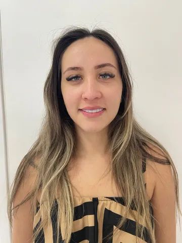 Faceta em resina !!  - Foto 3