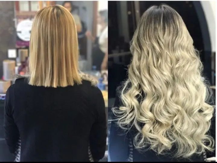 Colocação de cabelo - Foto 5