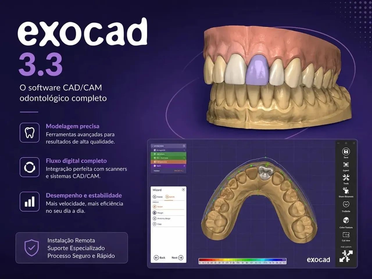 Exocad 3.3 DentalCAD - Software Odontológico com Instalação e Suporte