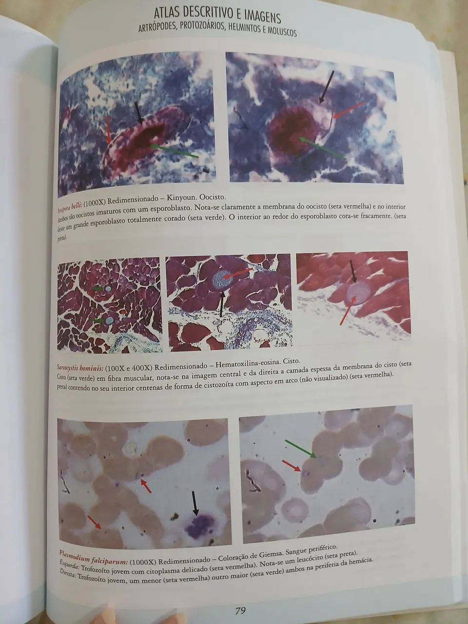 Atlas de Parasitologia Humana - 2ª edição - Foto 4