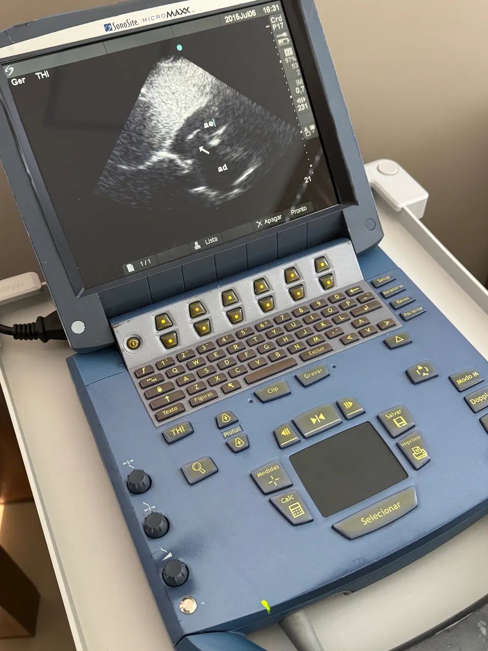 Ecocardiograma transtoracico Sonosite com sonda setorial - Foto 3
