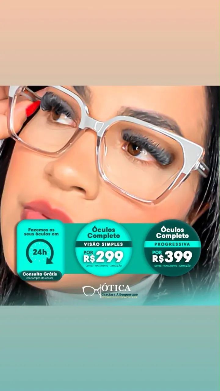 Óculo - Foto 2