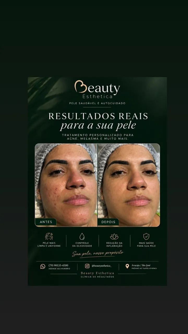 Limpeza de Pele Personalizada + Peeling de Diamante