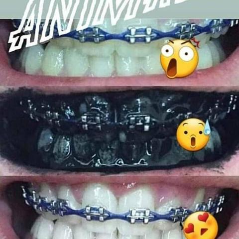 Gel dental de Carvão 70g- Clareamento dental Natural - Foto 5