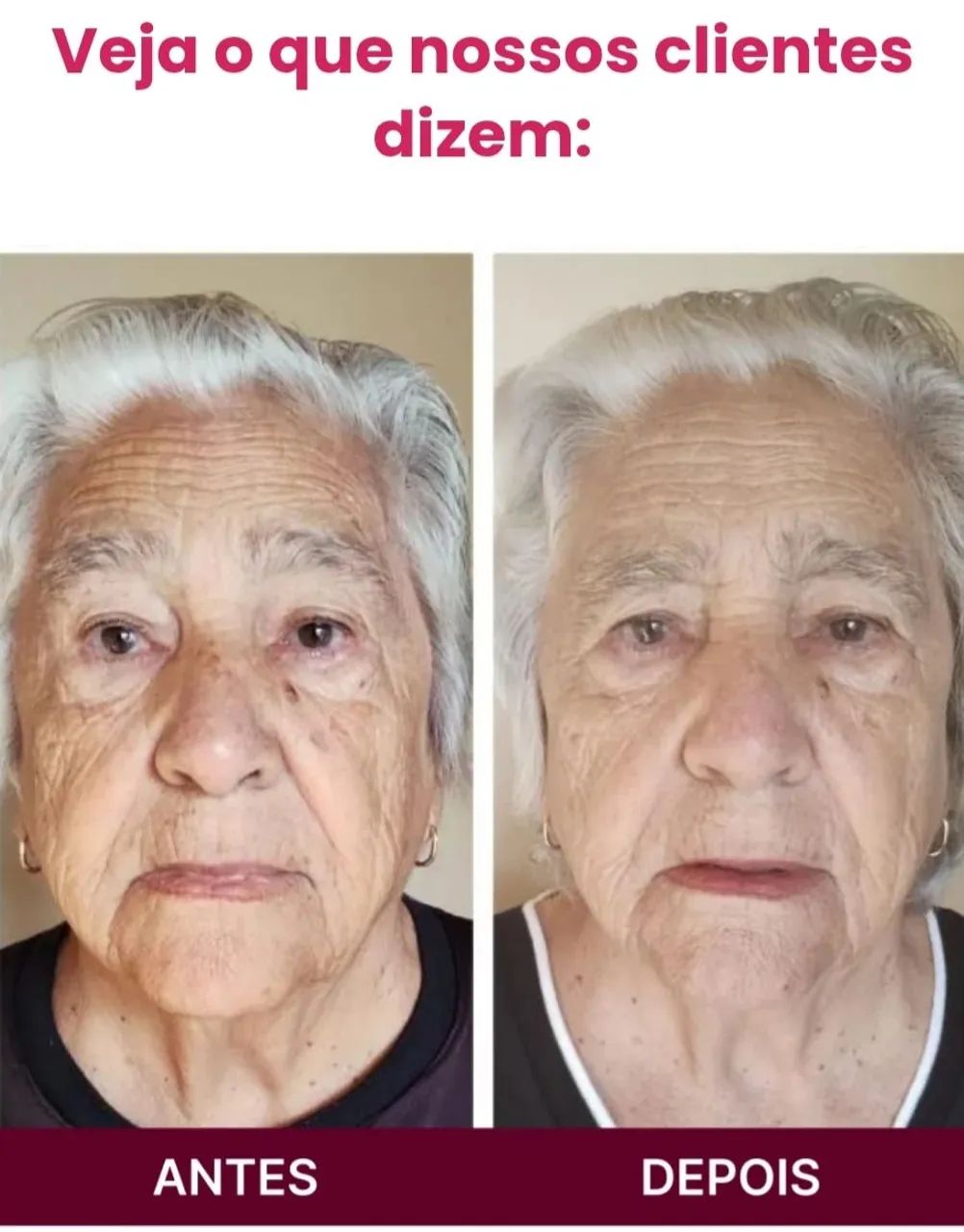 Revitalize sua pele com Rosa Mosqueta Amazônica - Foto 3