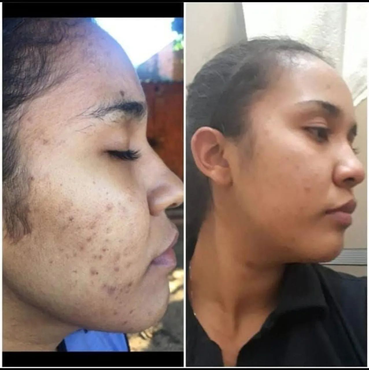 Creme de Tratamento Facial  - Foto 5