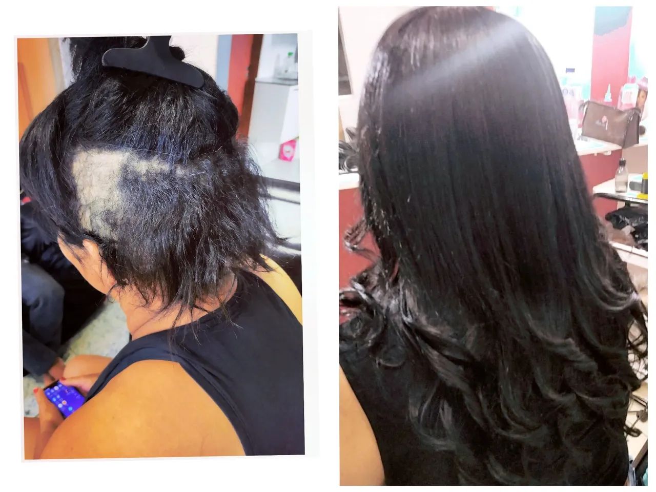 Colocação de cabelo - Foto 2