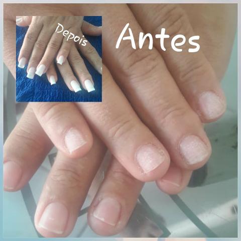 Unhas
