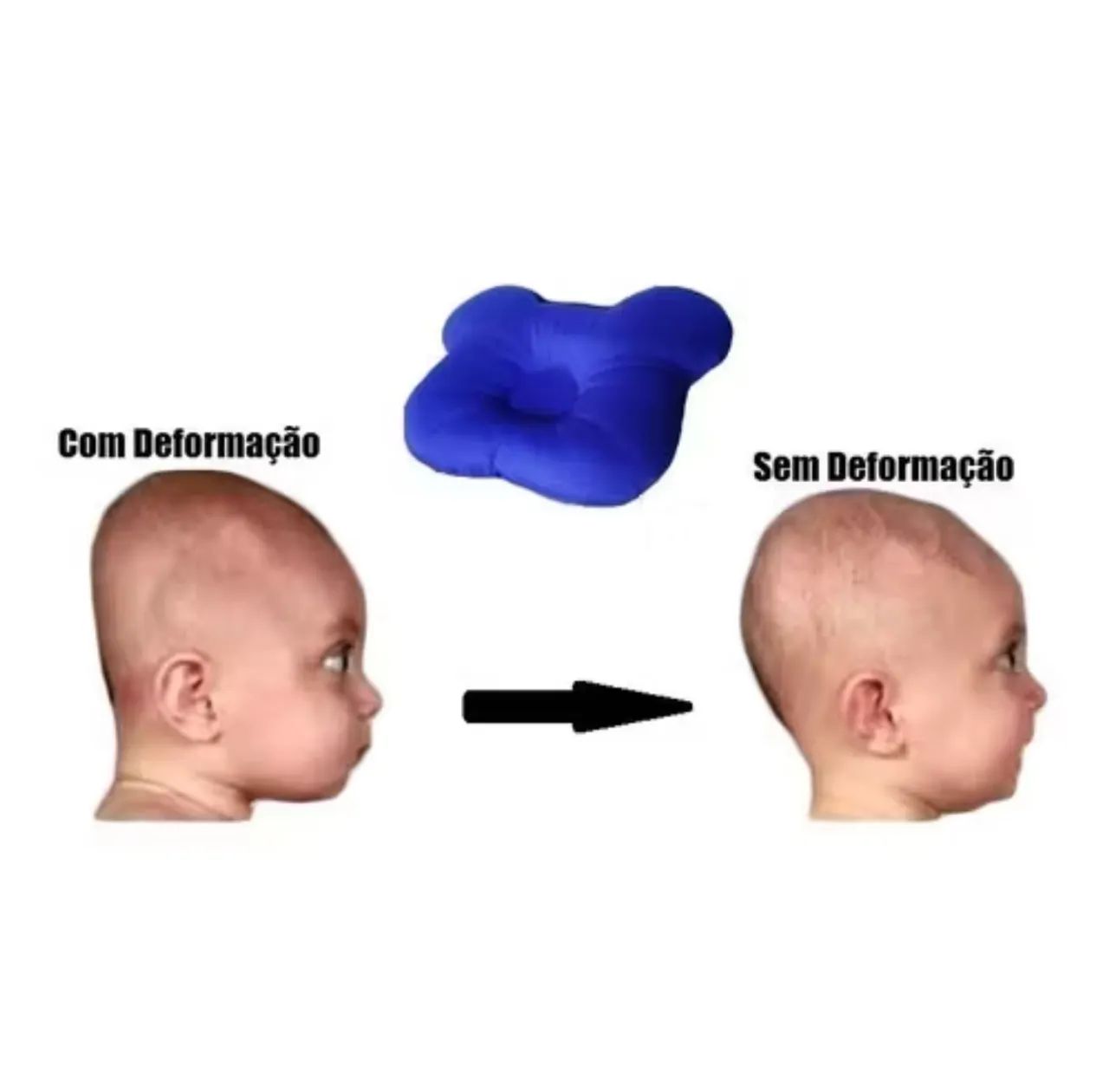 Anatomical Baby Pillow