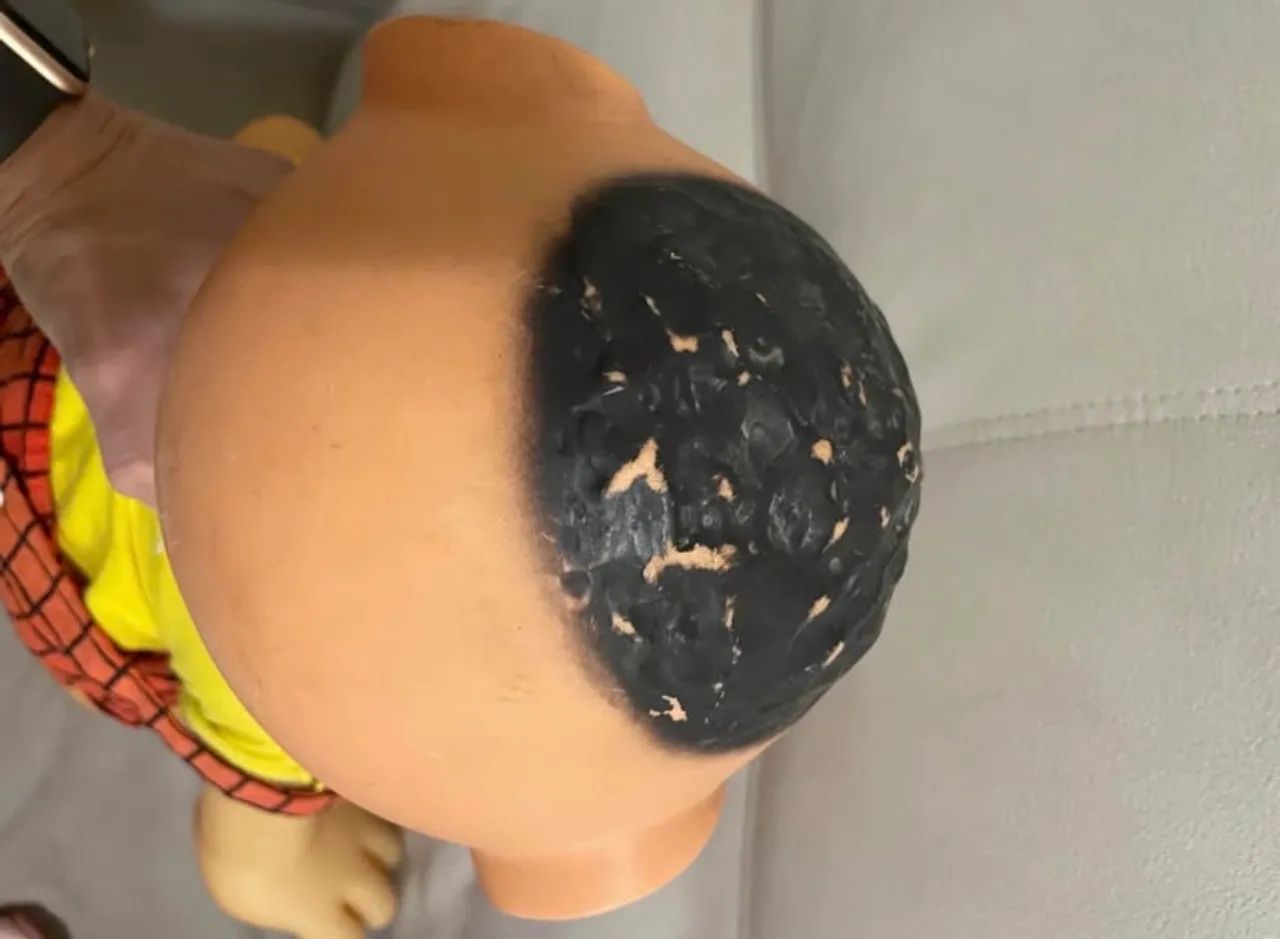 Cascão Mimo Turma da Mônica - Foto 2