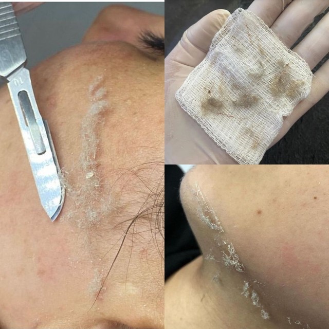 Dermaplaning facial Beleza e sa de Santa Cruz Industrial