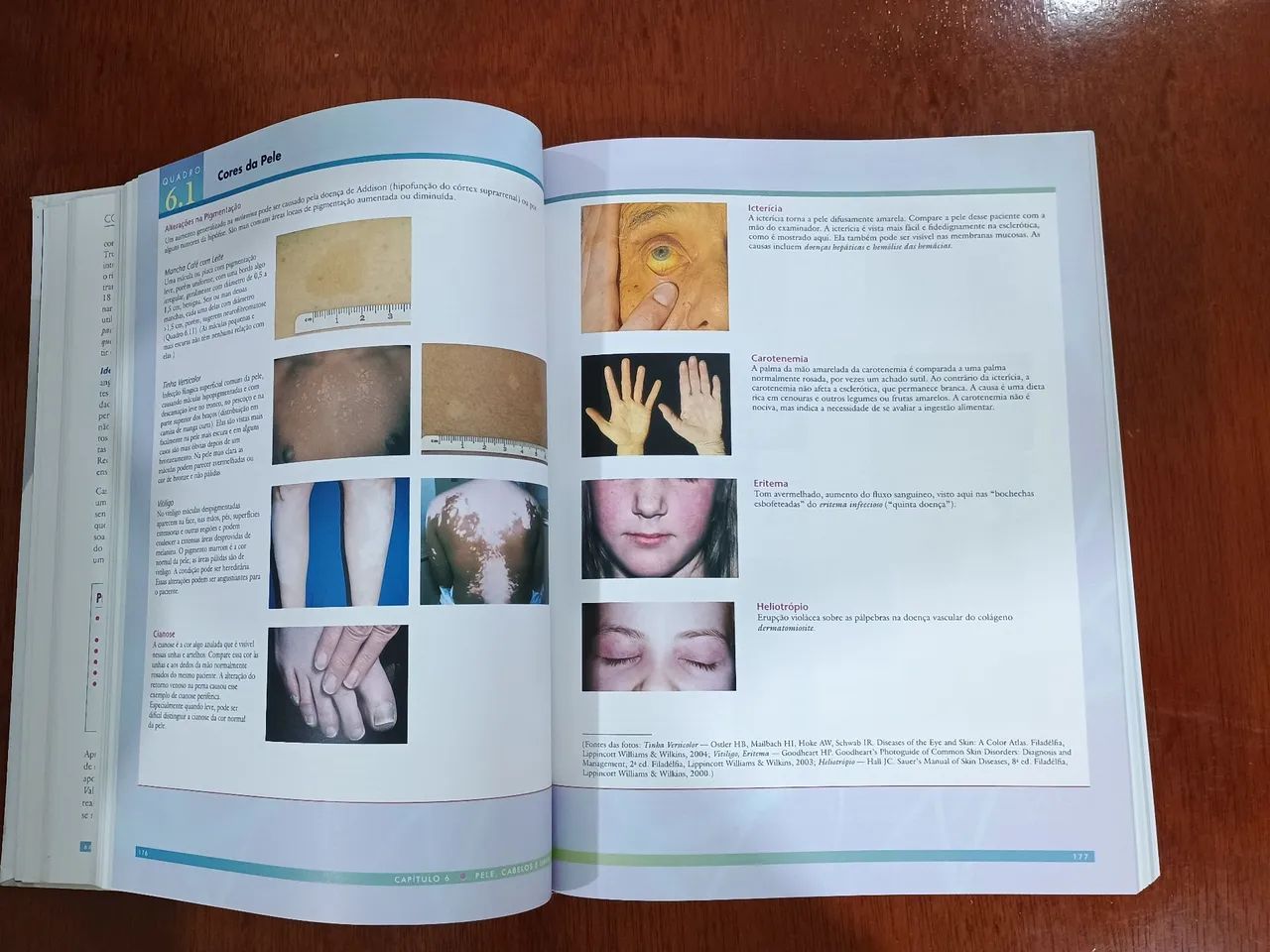 Livro Bates Propedêutica Médica 10ª Edição - Foto 5