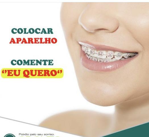 Coloque aparelho hoje mesmo de graça - Foto 2