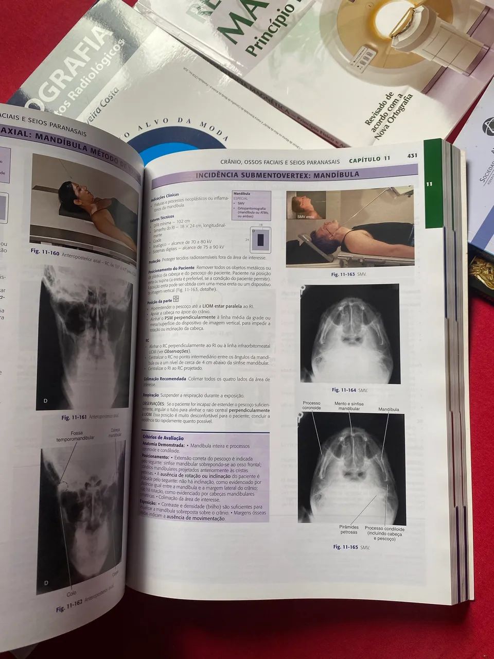Coleção de Livros de Radiologia - Excelente Oportunidade ! - Foto 2