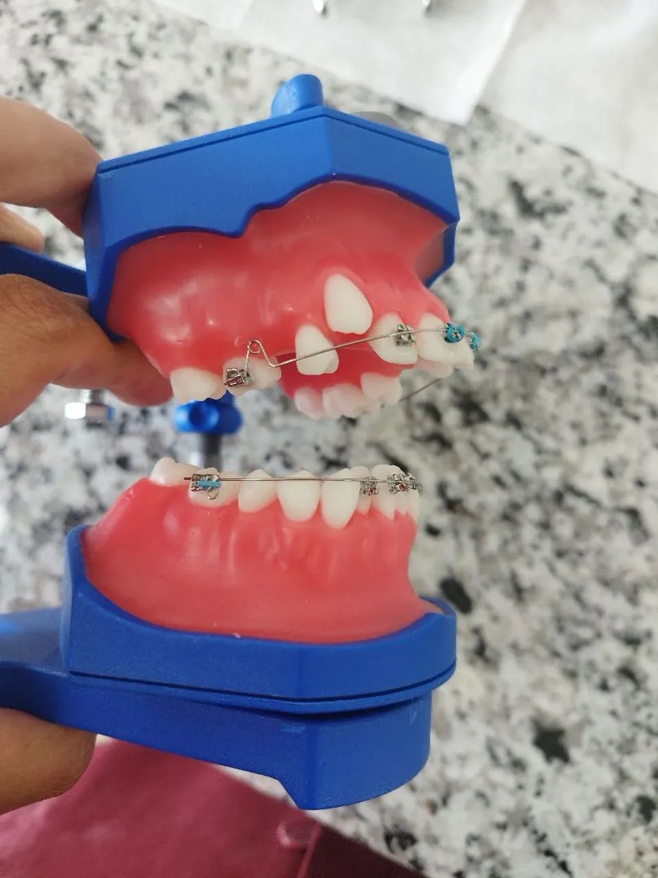 Vendo typodont ortodontia - Foto 2