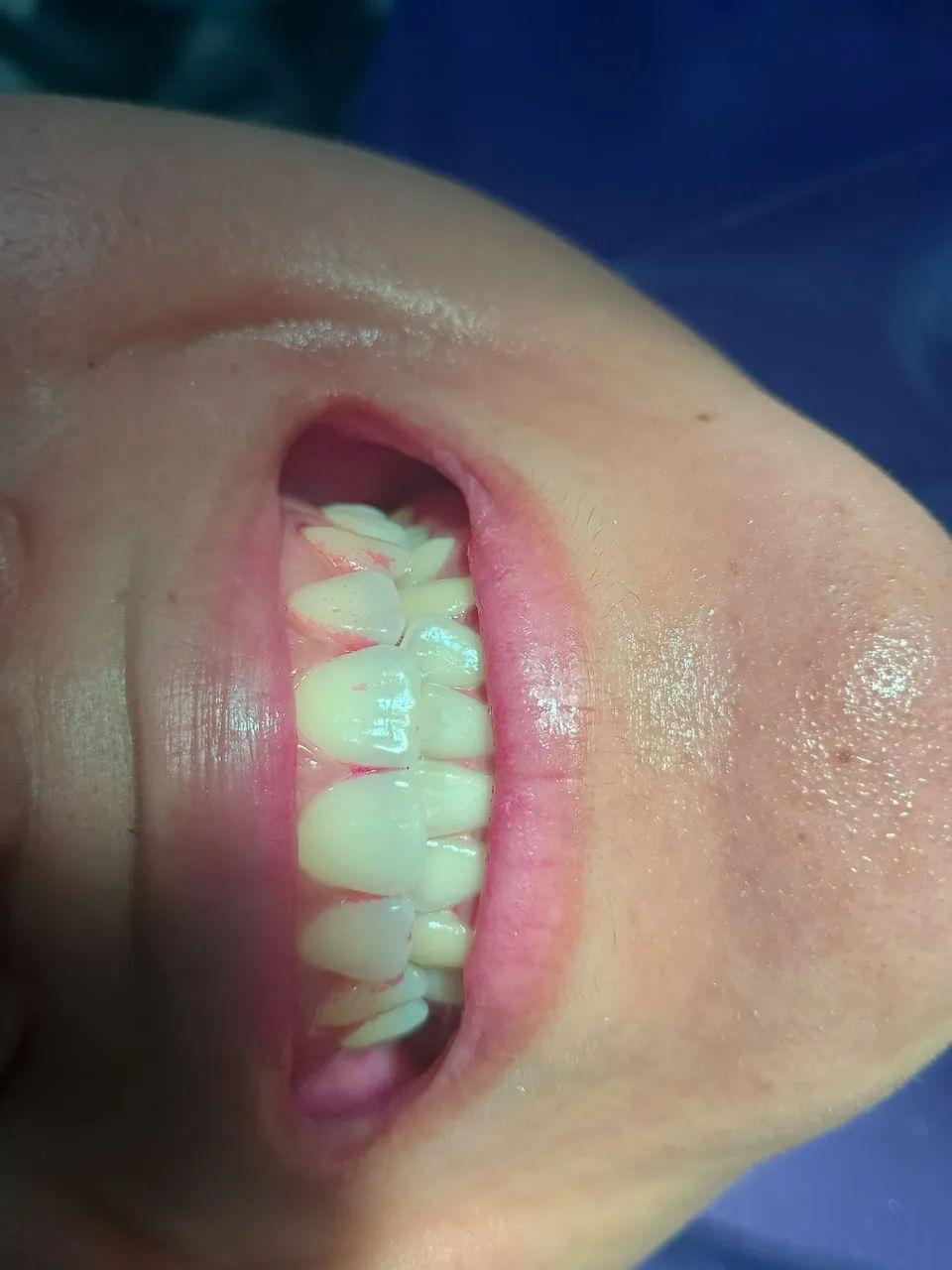 Paciente para odontologia  - Foto 5