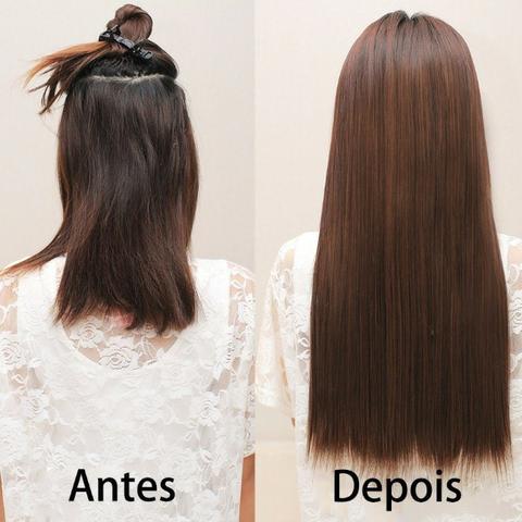 Aplique Removível - Foto 4