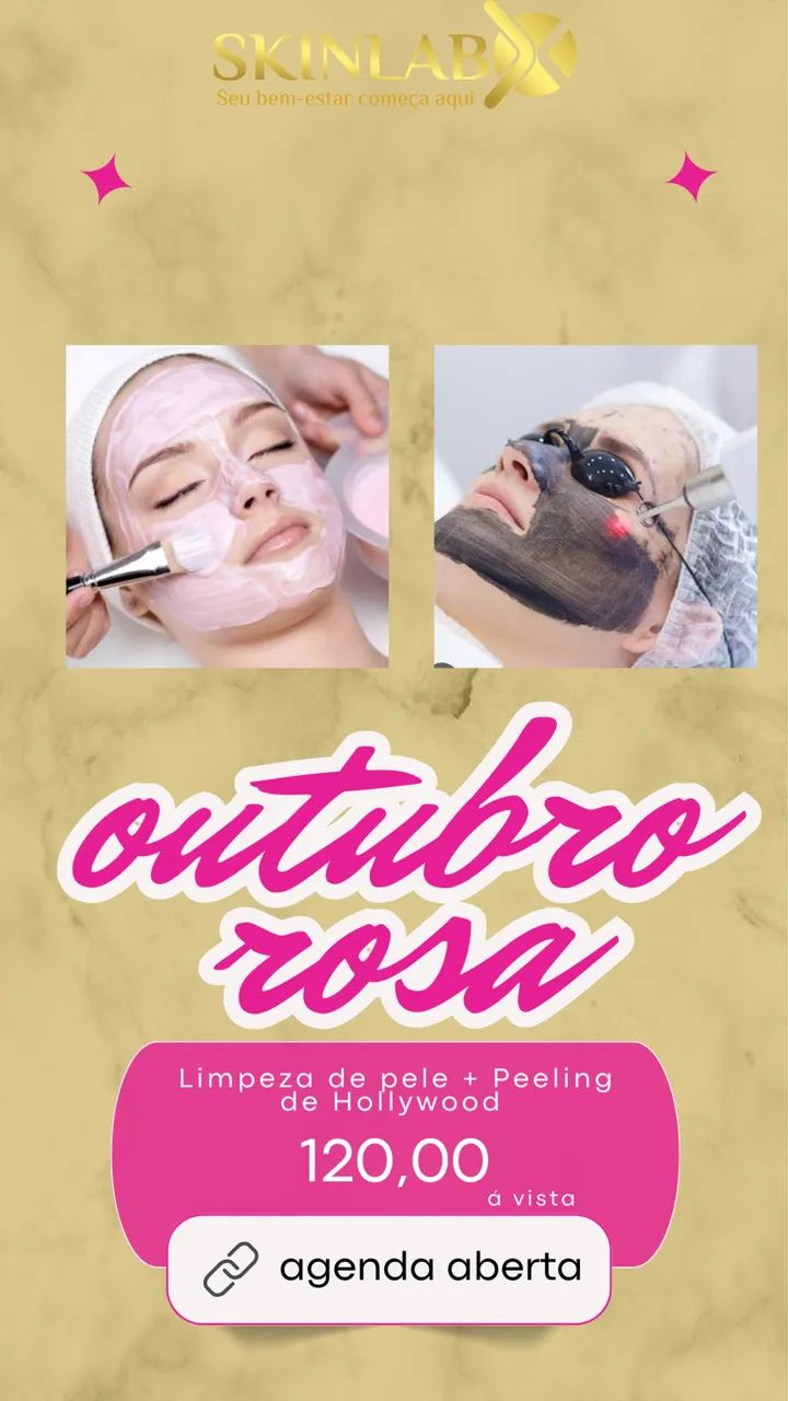 Remoção de tatuagem  - Foto 6